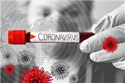 تولید واکسن ویروس کرونا توسط یک شرکت بیوتکنولوژی