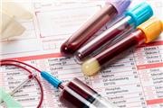 آزمایش خون 50 نوع سرطان را شناسایی می کند