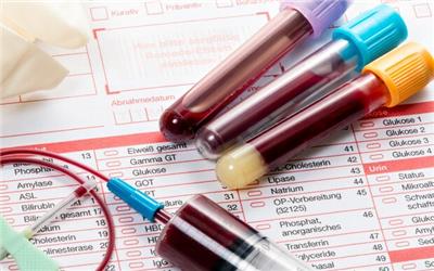 آزمایش خون 50 نوع سرطان را شناسایی می کند