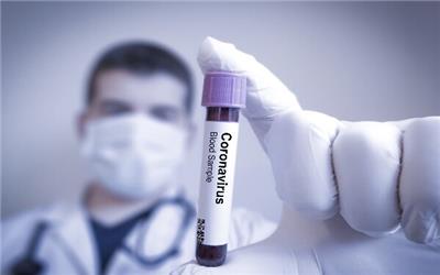 عامل کشندگی ویروس کرونا/ شایع ترین علائم کووید 19